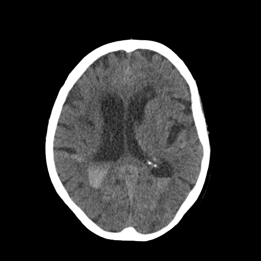 CT Scan Before Diagnosis